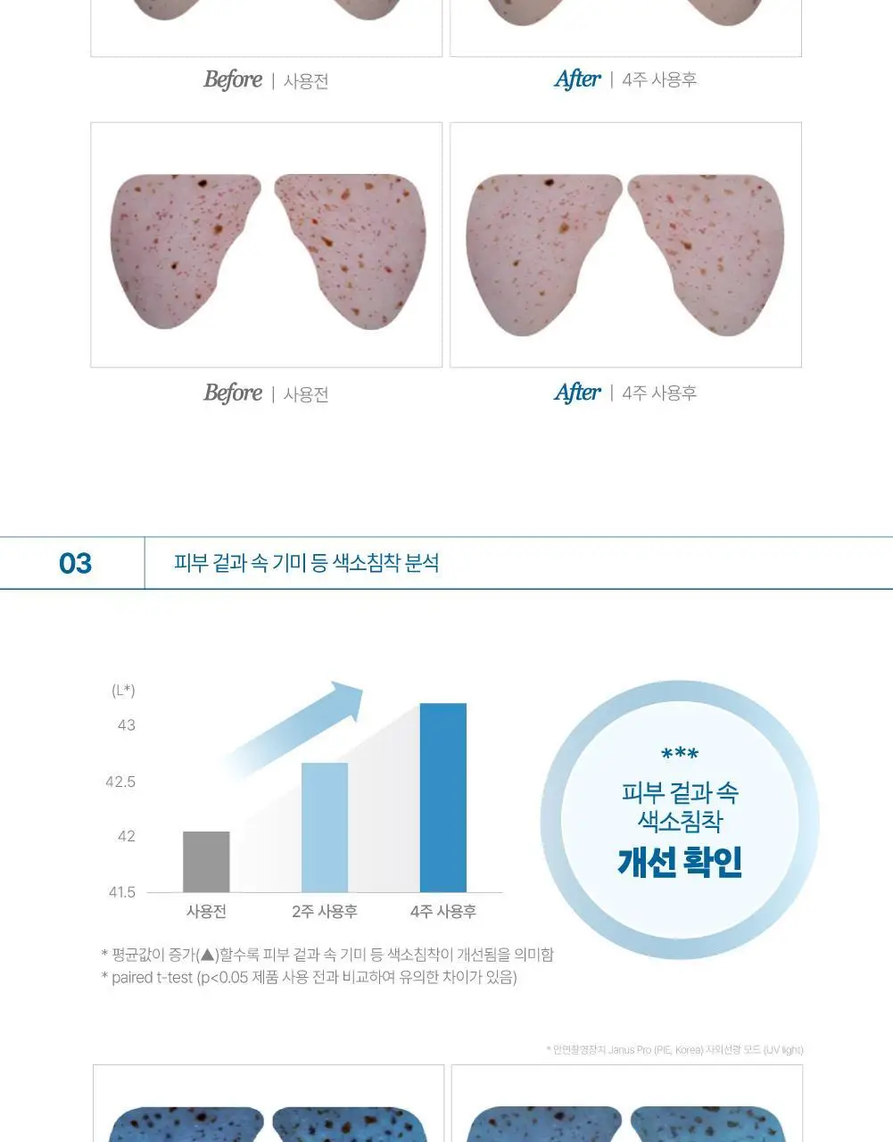 [리뷰이벤트] 라보타치 다크스팟 케어 패치 32매 상세페이지 32